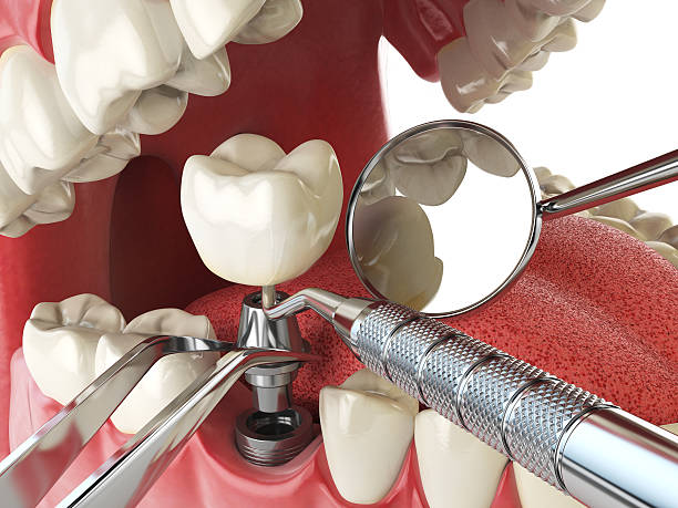 Best Cracked Tooth Emergency Dentist  in Washington, NJ